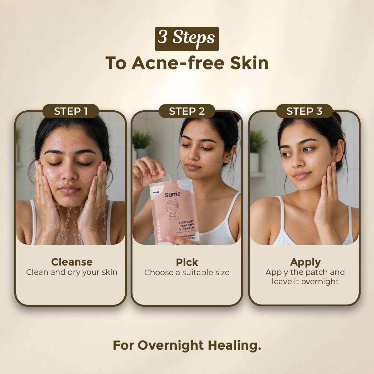 Face Acne Clearing Glo Patch - Pack of 36